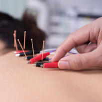 AcuGraph Diagnostic Technology & Acupuncture